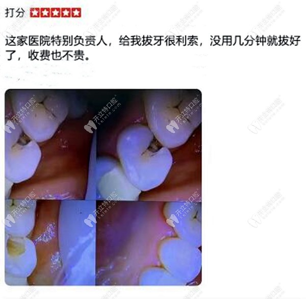 拔牙顧客評(píng)價(jià)藍(lán)天口腔