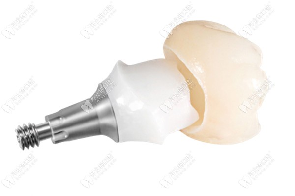 瑞士iti軟組織水平種植體