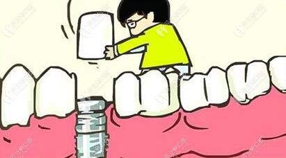 什么情況下能走即刻負(fù)重