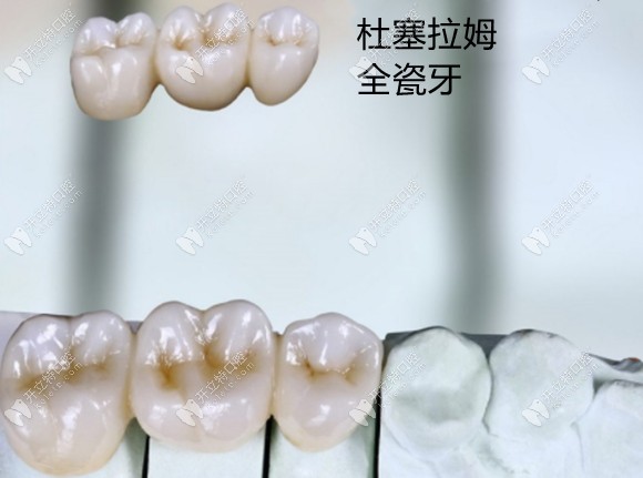 德國杜塞拉姆樂瓷氧化鋯全瓷牙好還是威蘭德好,你猜對了嗎