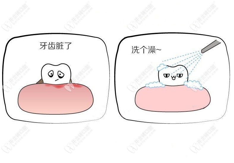 一起去佛山曙光金子做只要3600元起的韓國登騰進口種植牙吧