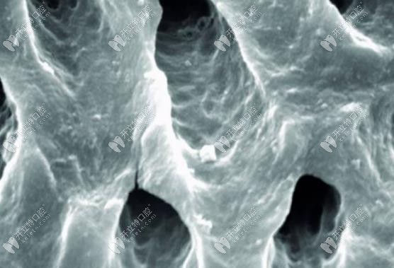 經(jīng)過EDTA沖洗過后的根管外觀