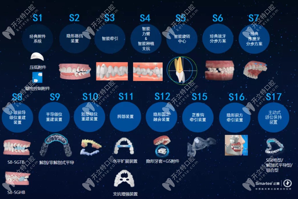恭?！墩胖鲃有皖M位保持器S17》新款亮相
