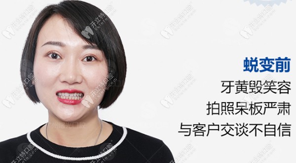 牙黃毀笑容，拍照呆板