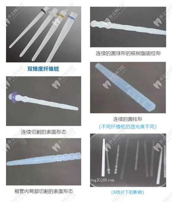 不同錐度的纖維樁圖示圖