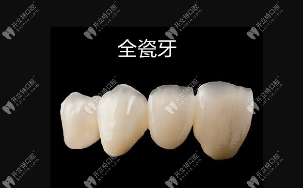 氧化鋯全瓷牙