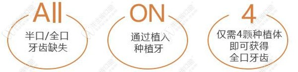 All-on4種牙