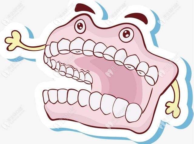 兒童要佩戴活動義齒修復