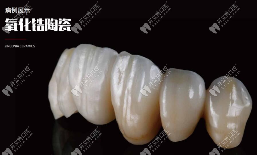 愛爾創(chuàng)全瓷牙冠美學修復